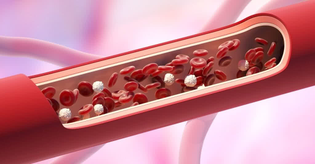 Imagem de artéria com células vermelhas e brancas do sangue em nível normal de leucócitos. Essa imagem pode ajudar a entender o processo de Bypass arterial.