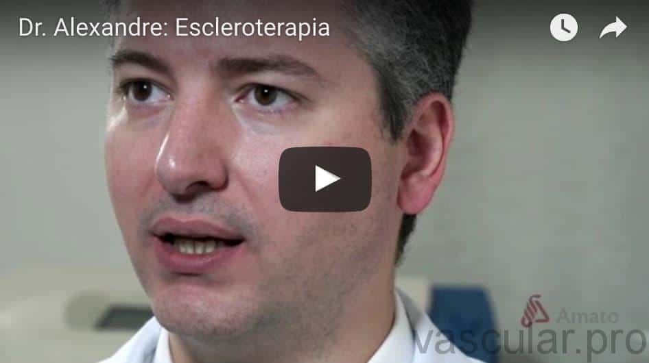 Escleroterapia: video sobre aplicação nos vasinhos<span class=