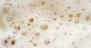 Detalhe macro da textura da espuma de cerveja fresca com bolhas. Imagem relacionada ao artigo sobre tratamento de vasinhos.