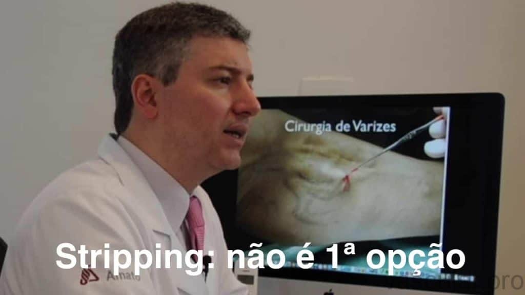Cirurgia de varizes