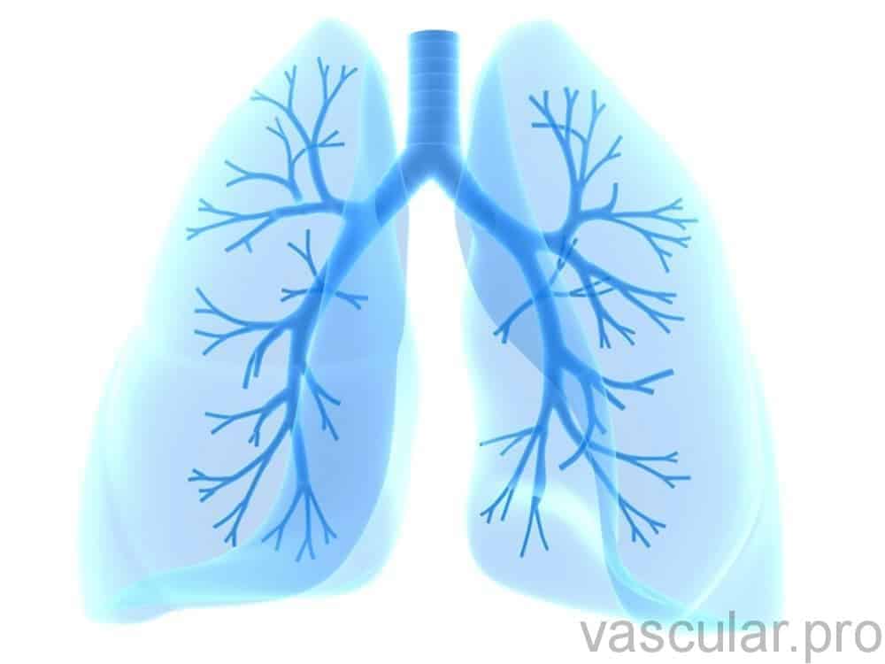 embolia pulmonar - Terapia