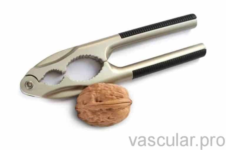 Síndrome de Nutcracker sintomas, tratamentos e possibilidades de cura.