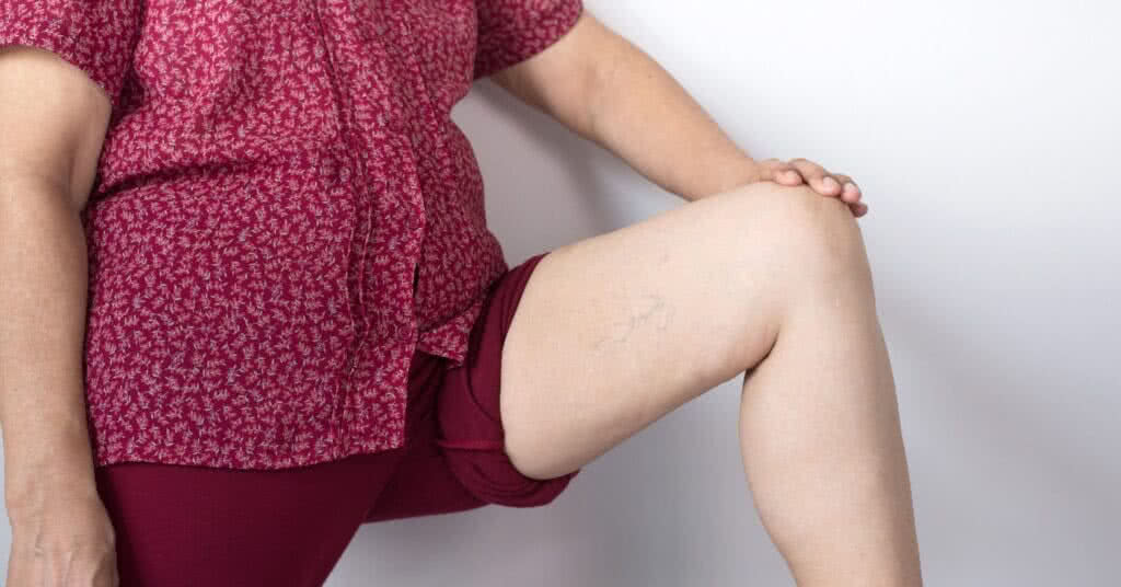 Imagem de close-up das pernas de uma idosa asiática com varizes, indicando os efeitos do tempo prolongado em pé.