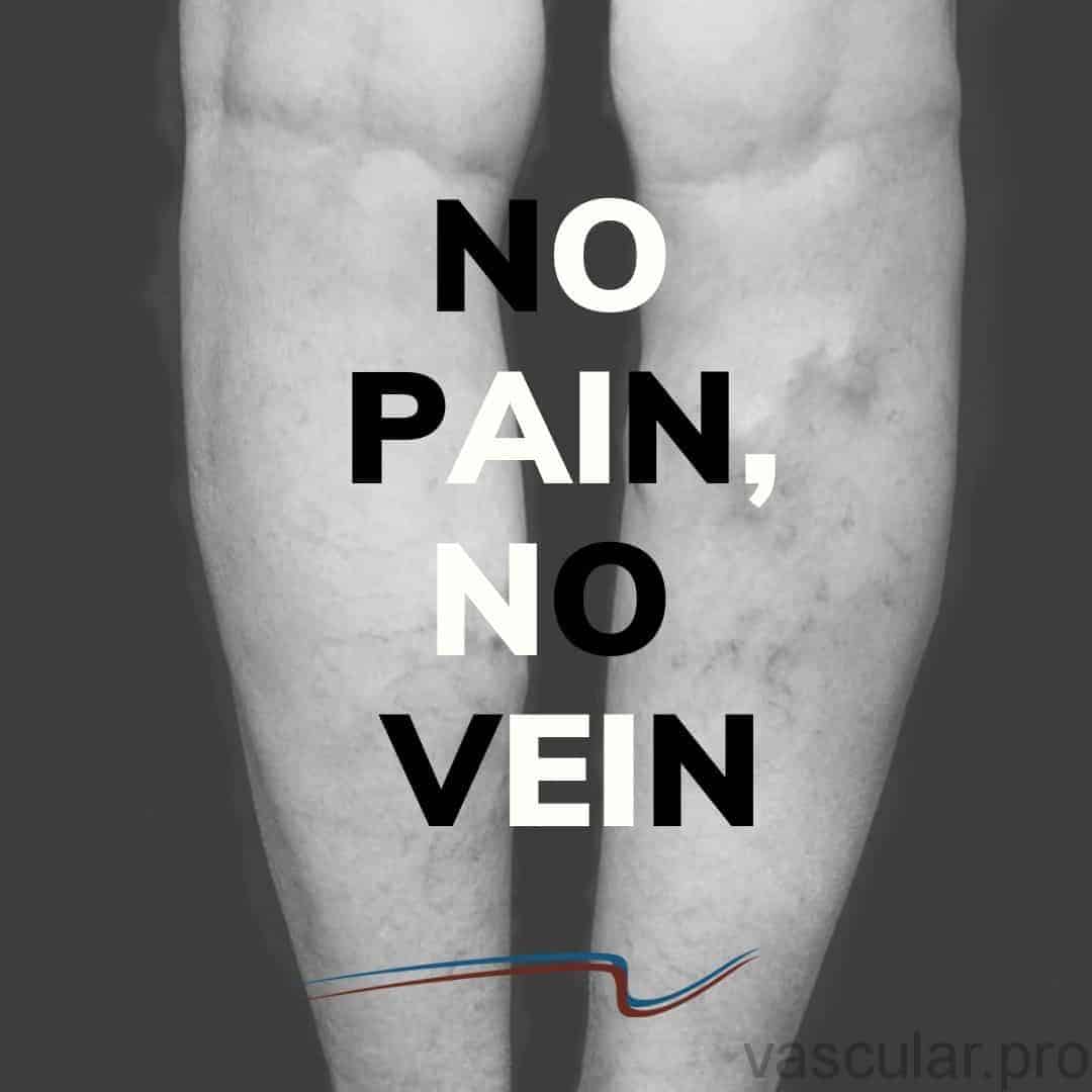 No pain, no vein: campanha vasinhos sem dor<span class=