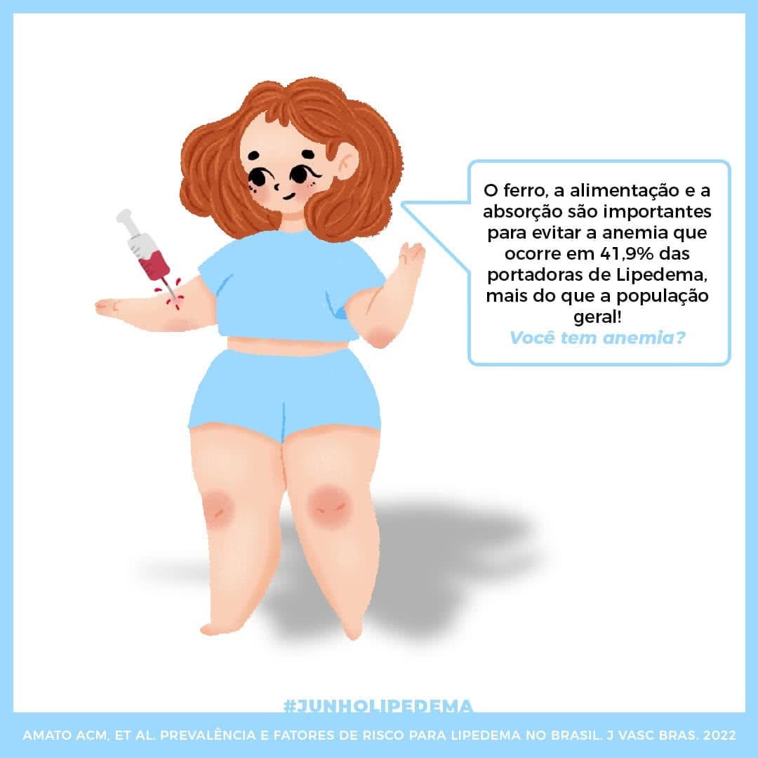 Lipedema: Como reduzir a gordura das pernas - AngioLife