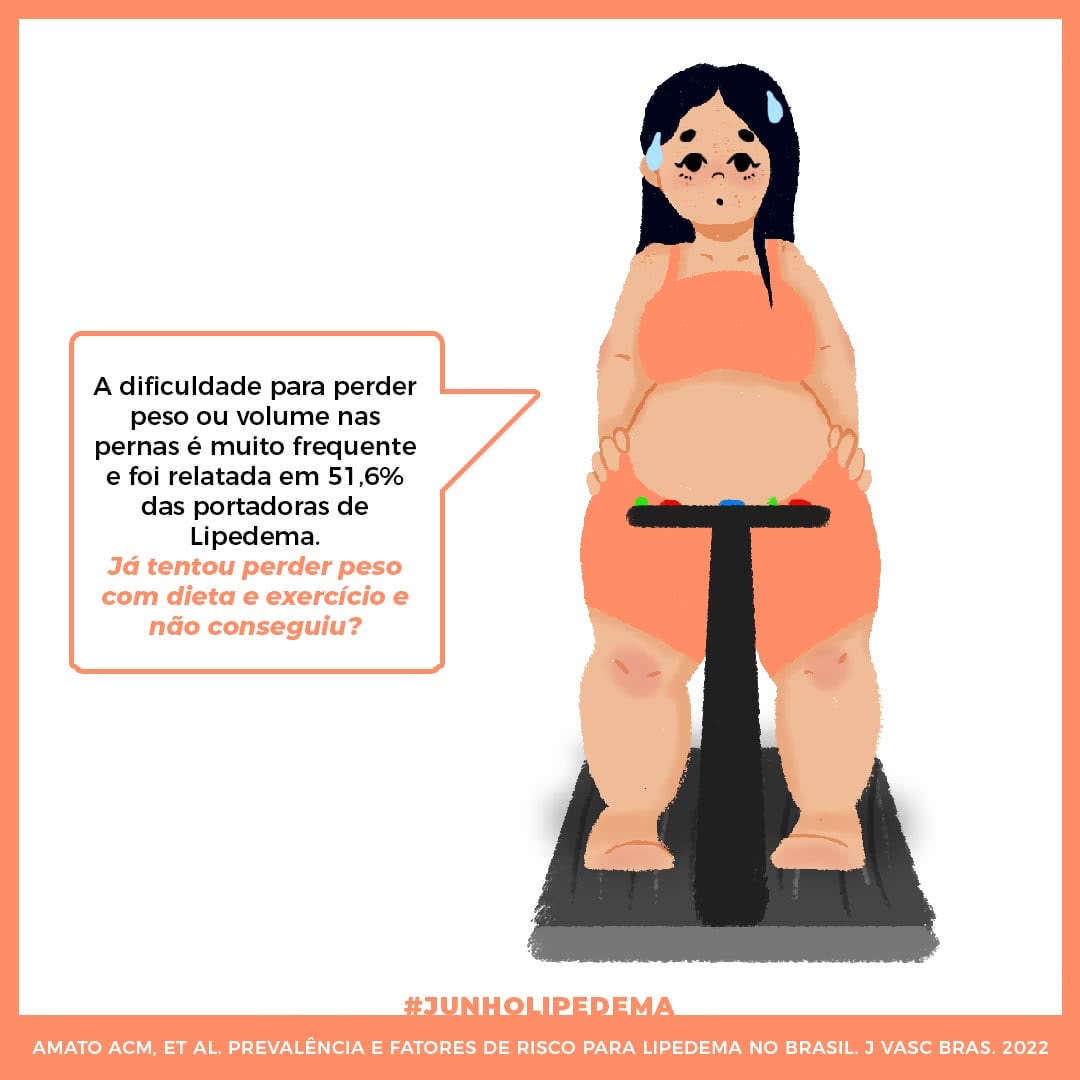 Lipedema: acúmulo de gordura em pernas e braços afeta 11% das mulheres -  Revista Ceará