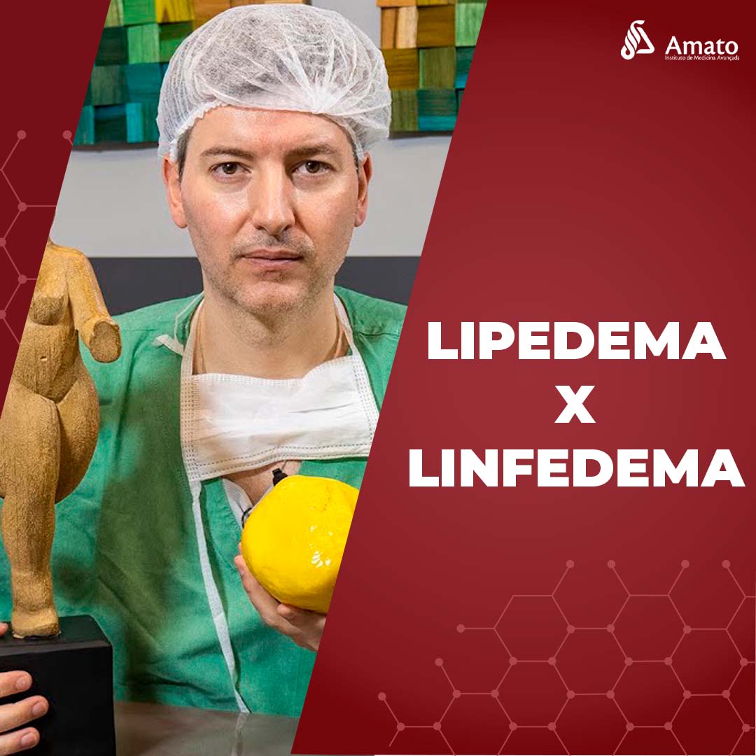 Qual a Diferença Entre Lipedema e Linfedema?