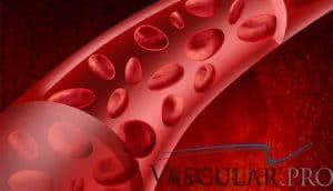 cirurgião vascular são paulo - Cérebro