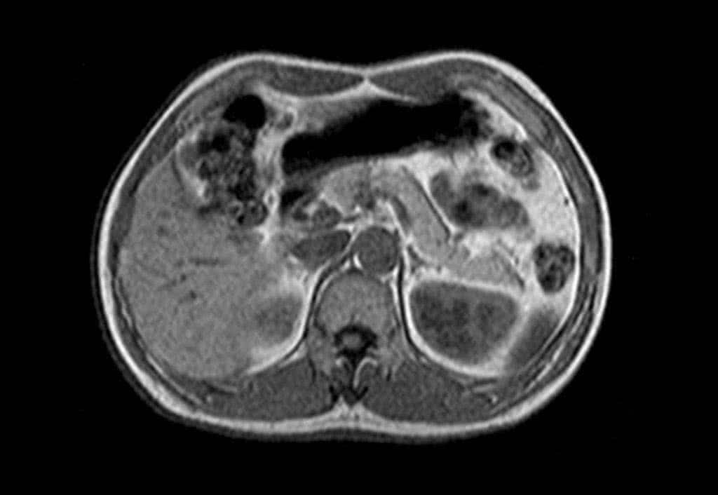 angioressonância - tomografia computadorizada