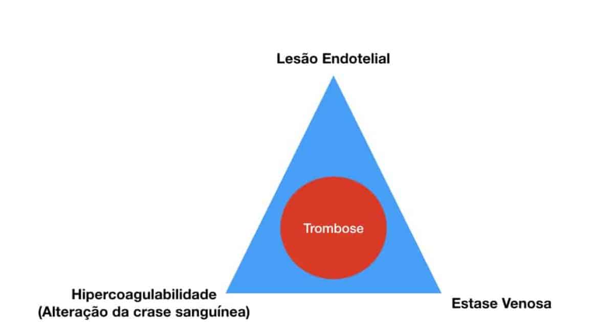 Triade De Virchow Trombose - LIBRAIN