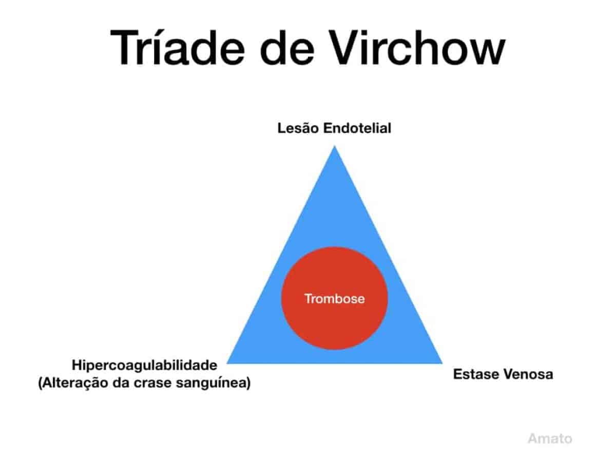 Tríade de Virchow - Vascular.pro