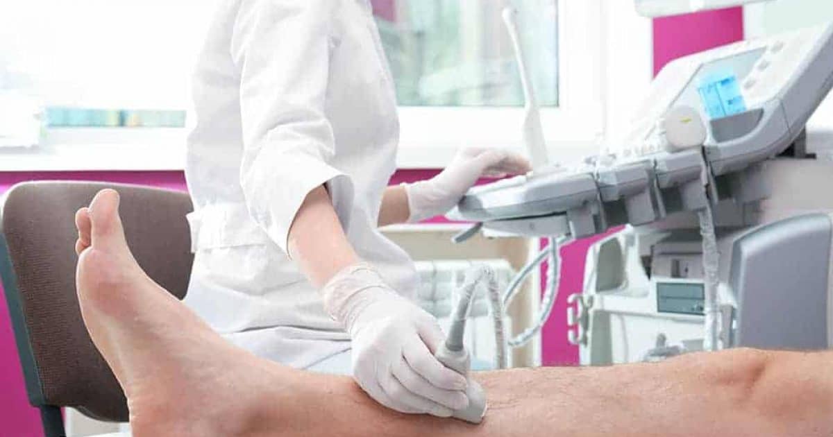 Ultrassonografia vascular com doppler colorido de alta definição saiba