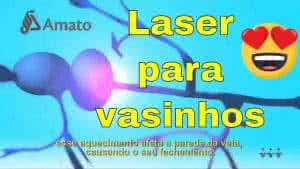 Gráficos