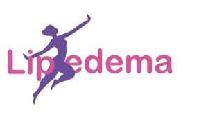 Imagem de uma mulher com lipedema, uma condição médica que causa acúmulo de gordura nas pernas e braços, em um fundo azul elétrico com elementos gráficos. Esta imagem ilustra a condição de lipedema, que afeta principalmente mulheres e pode causar dor e desconforto. É importante buscar tratamento médico para gerenciar os sintomas e melhorar a qualidade de vida. Esta imagem é parte do boletim de novos artigos sobre lipedema, que traz informações atualizadas sobre a condição e opções de tratamento.