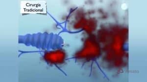 Cirurgia