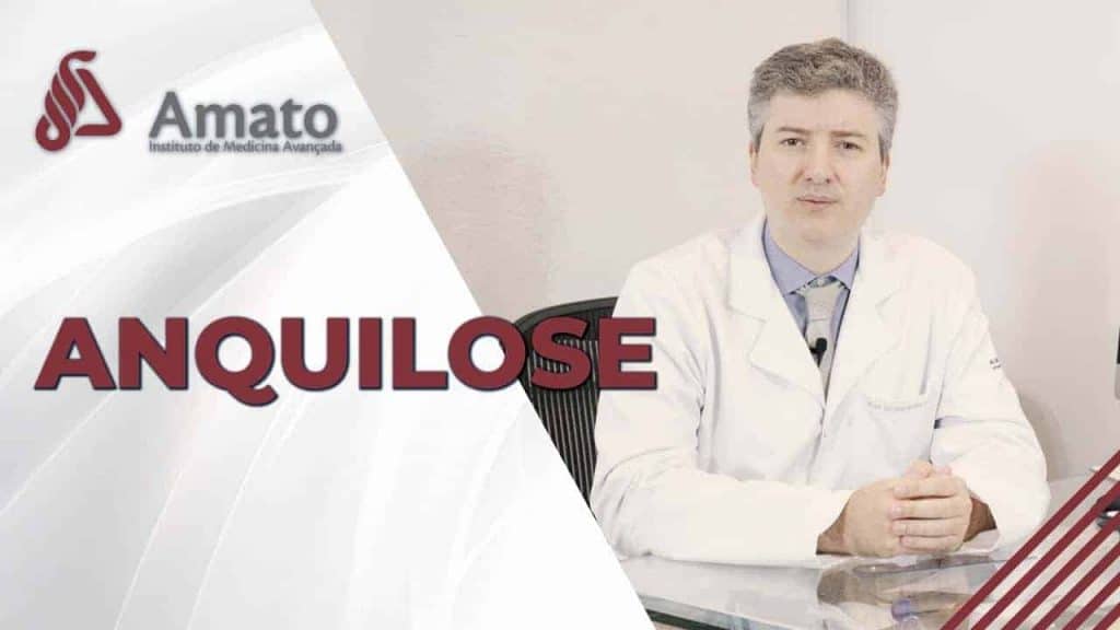 anquilose