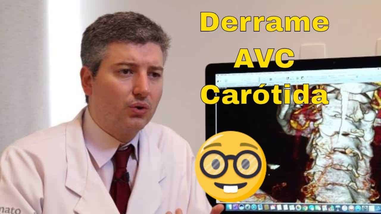 Derrames e a artéria carótida: Dr Alexandre Amato<span class=