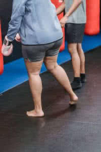 Lipedema