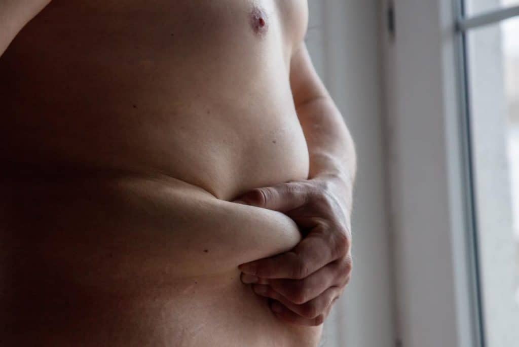 Índice de Adiposidade Corporal - Obesidade