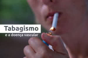 tabagismo - Tabagismo