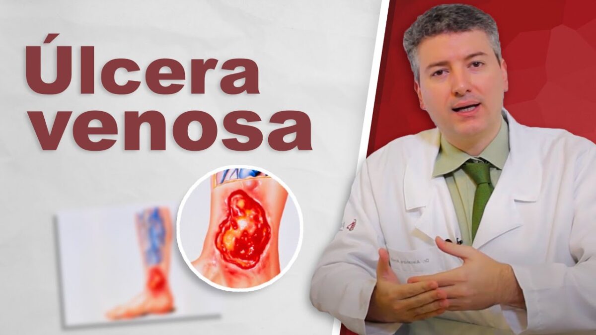 Úlceras: causas e cuidados - Vascular.pro